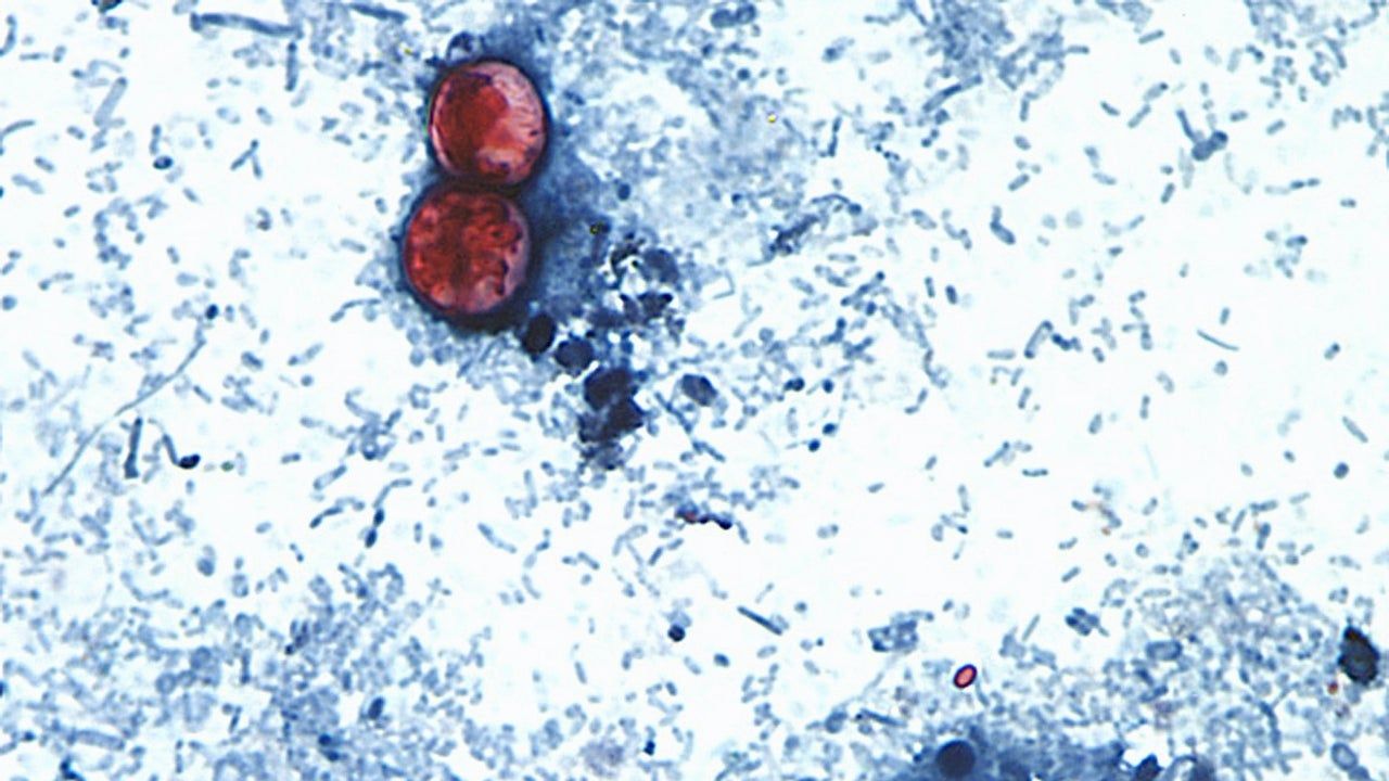 Cyclospora cayetanensis oocysts shown in a CDC microscope image connected to coverage of the outbreak. - CDC via AP