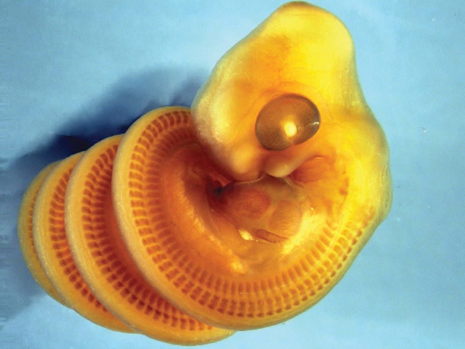 A stained snake embryo showing developing muscle blocks in the trunk and right-handed coiling. - Raul Diaz / California State University Los Angeles